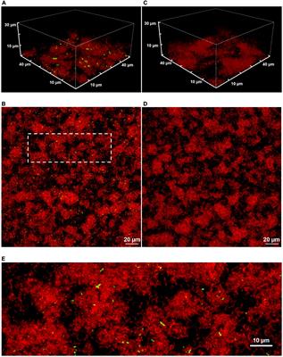 Spatial Correlations and Distribution of Competence Gene Expression in Biofilms of Streptococcus mutans